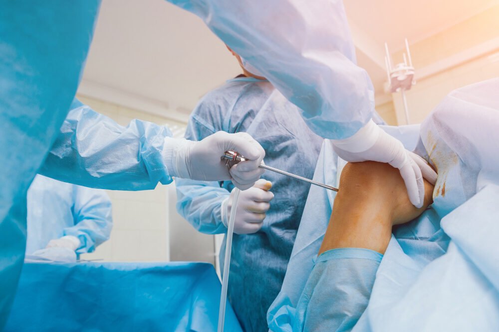 Expert Arthroscopy Services for Joint Care | Advanced Health Associates