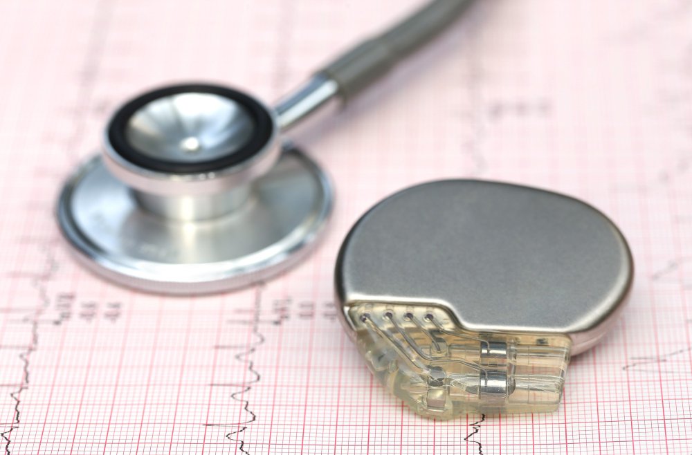 Pacemakers & ICD Therapy | Advanced Health Associates
